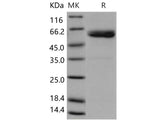 Recombinant Human ULBP1/N2DL1 Protein (His & Fc Tag)(Active)