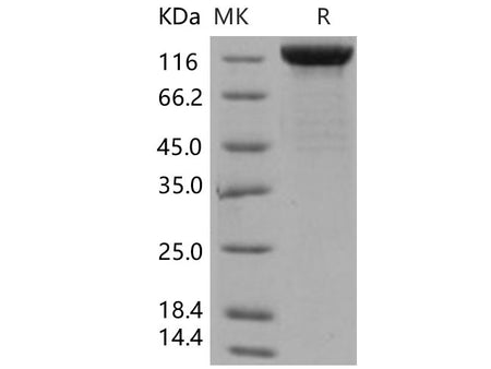 Recombinant Human LIFR/CD118 Protein (His Tag)(Active)