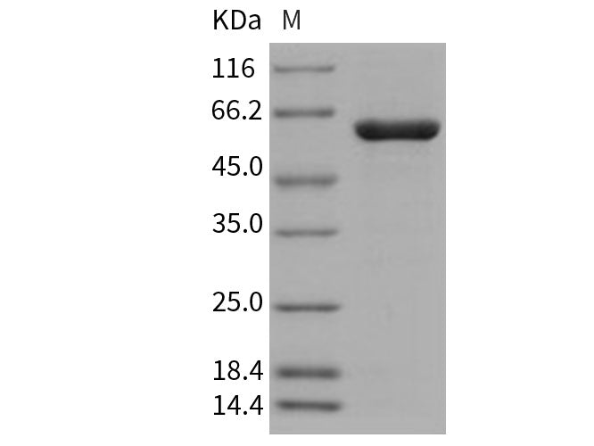 Recombinant Human PTPN2/PTPT Protein (His & GST Tag)(Active)