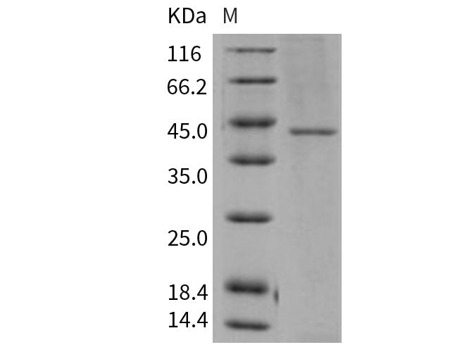 Recombinant Human TCN2 Protein (His Tag)(Active)