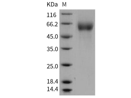 Recombinant Human FGFR4/CD334 Protein (His Tag)(Active)