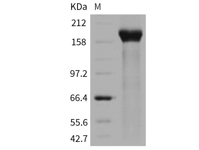 Recombinant Human PAPPA2/Pappalysin 2 Protein (His Tag)