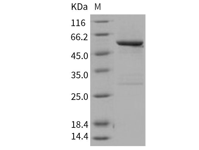 Recombinant Human SPG21 Protein (GST Tag)
