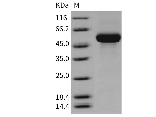 Recombinant Human CD131/CSF2RB Protein (His Tag)(Active)