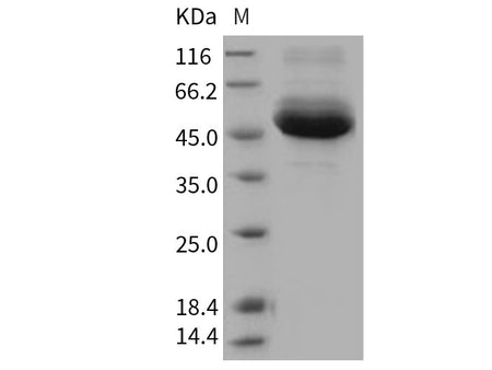 Recombinant Human Cathepsin A/CTSA Protein (His Tag)