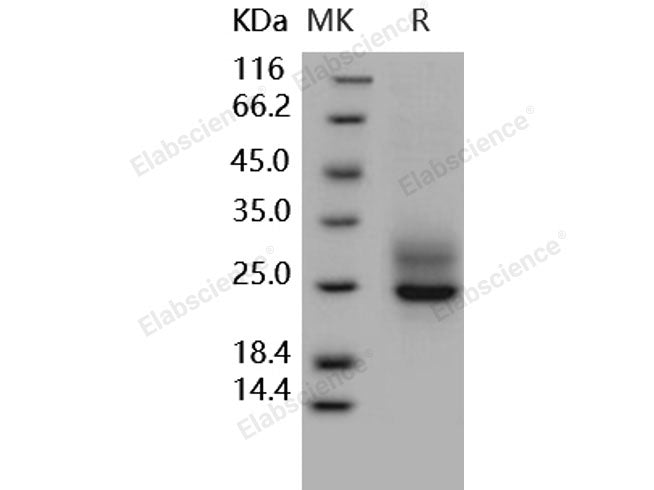 Recombinant Human Frizzled-5/FZD5 Protein (His Tag)