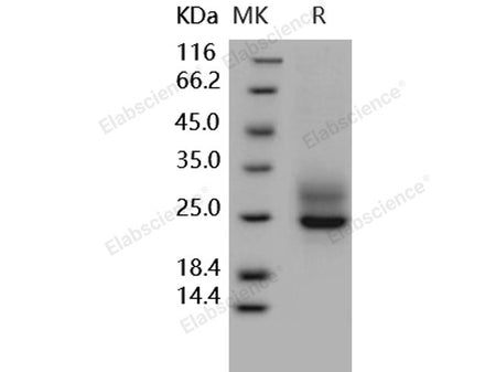 Recombinant Human Frizzled-5/FZD5 Protein (His Tag)