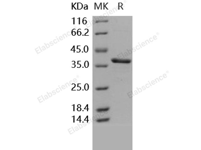 Recombinant Human Carbonic Anhydrase 8/CA8 Protein (His Tag)(Active)