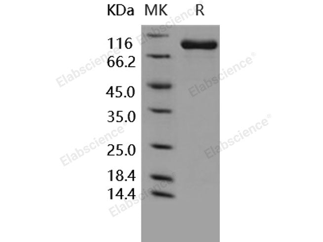 Recombinant Human FAP/Seprase Protein (His Tag)(Active)