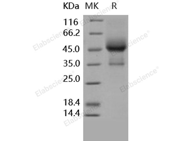 Recombinant Human TGFBR1/ALK-5 Protein (His & Fc Tag)(Active)