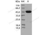 Recombinant Human Carbonic Anhydrase 14/CA14 Protein (HEK293 Cells, His Tag)