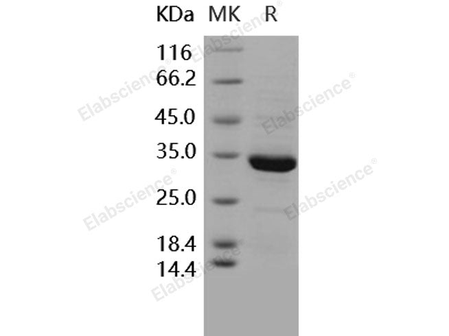 Recombinant Human ANXA5/Annexin Ⅴ/Annexin A5 Protein