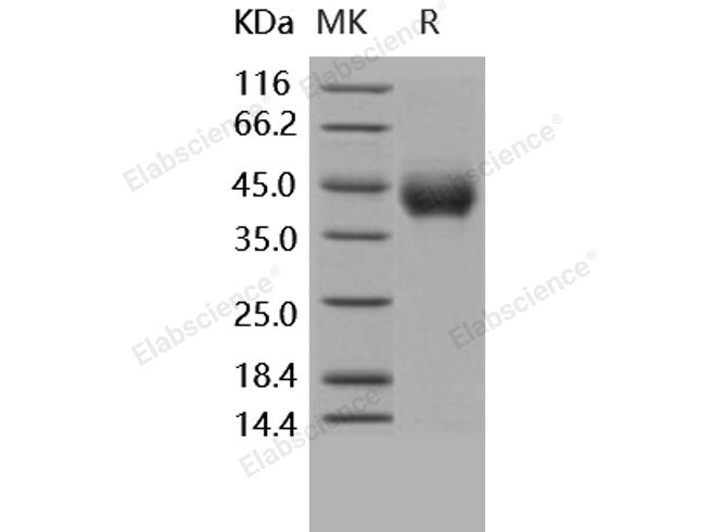 Recombinant Human TNFRSF1B/CD120b Protein (His Tag)(Active)