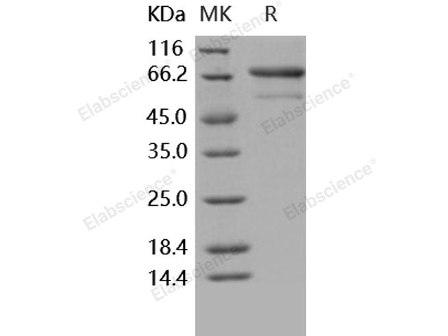 Recombinant Human TNFRSF1B/CD120b Protein (His & Fc Tag)(Active)
