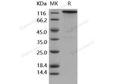 Recombinant Human/Rhesus HER4/ErbB4 Protein (Fc Tag)(Active) - MSE Supplies LLC