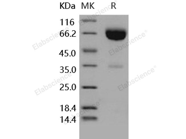 Recombinant Human IFNAR2/IFNABR Protein (Fc Tag)(Active)