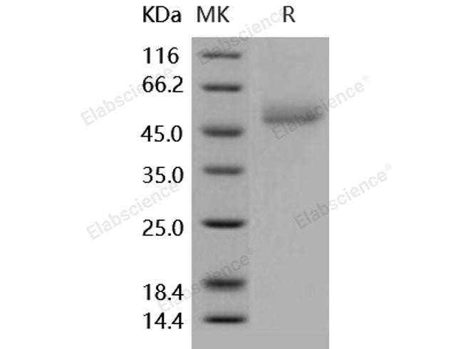 Recombinant Human ICOS/AILIM Protein (His & Fc Tag)(Active)