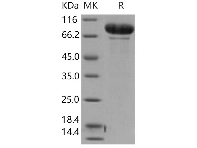 Recombinant Human MMP-9 Protein (Active)