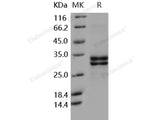 Recombinant Human HMGB1/HMG1 Protein (His Tag)(Active)