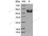 Recombinant Human SerpinA1/A1AT Protein (His Tag)(Active)