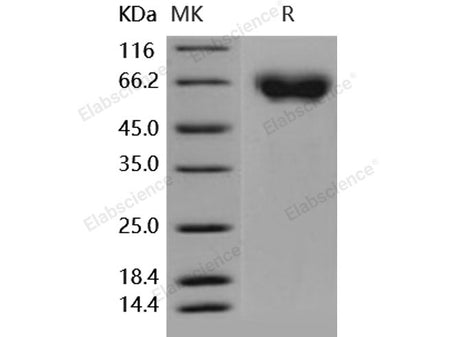 Recombinant Human Axl Kinase Protein (His Tag)