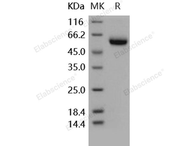 Recombinant Human Osteoprotegerin/TNFRSF11B Protein (His Tag)(Active)