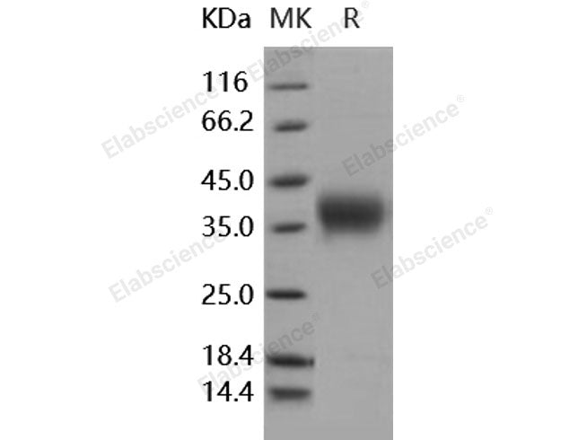Recombinant Human Activin RIIA/ACVR2A Protein (His Tag)(Active)
