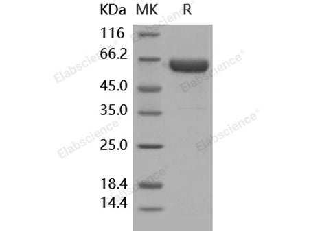 Recombinant Human Activin RIIA/ACVR2A Protein (Fc Tag)(Active)