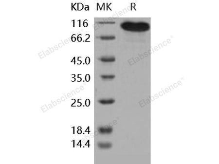 Recombinant Human BCAM Protein (Fc Tag)