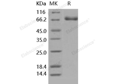Recombinant Human EphB4/HTK Protein (His Tag)(Active)