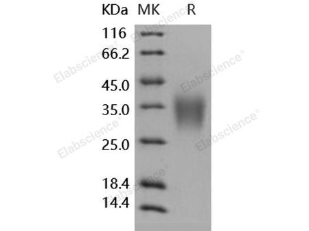 Recombinant Human ACVR2B/ActivinR-IIB Protein (His Tag)(Active)
