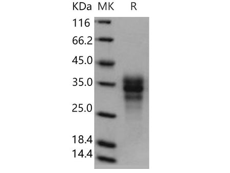 Recombinant Human Fas/CD95/TNFRSF6 Protein (His Tag)(Active)