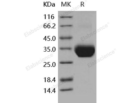 Recombinant Human Layilin/LAYN Protein (His Tag)