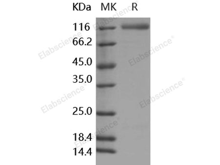 Recombinant Human ECE-2 Protein (His Tag)