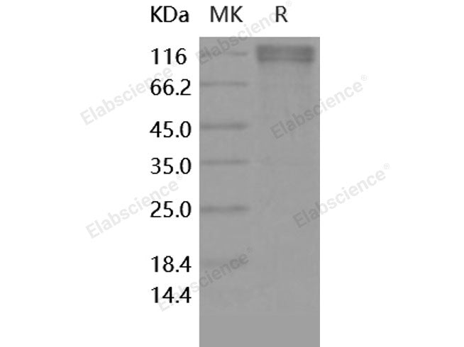 Recombinant Human ECE-2 Protein (Fc Tag)