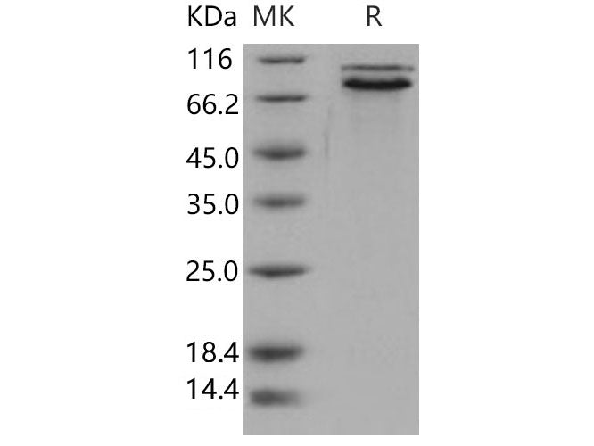 Recombinant Human E-Cadherin/CDH1 Protein (His Tag)(Active)