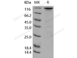Recombinant Human HER3/ErbB3 Protein (Fc Tag)(Active)
