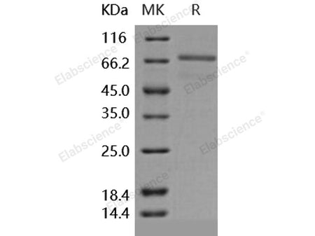 Recombinant Human EphB6 Protein (Active)