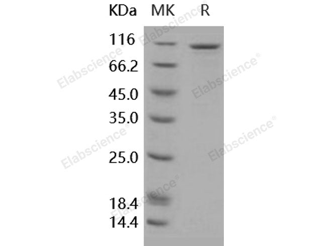 Recombinant Human EphB6 Protein (Fc Tag)(Active)