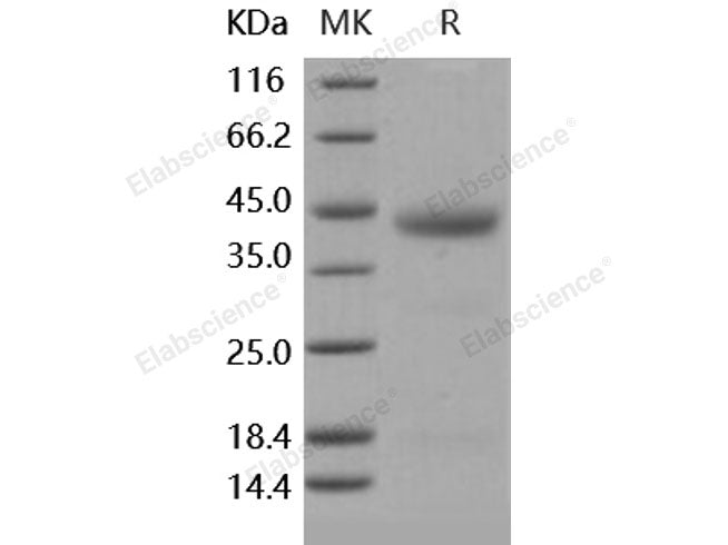 Recombinant Human ESAM Protein