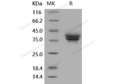 Recombinant Human ESAM Protein (aa 1-248, His Tag)