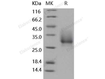 Recombinant Human CD147/Basigin Protein (His Tag)
