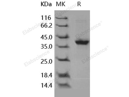 Recombinant Human S100A2 Protein (Fc Tag)
