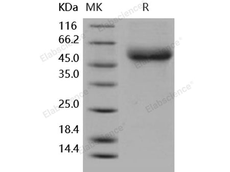 Recombinant Human IL18RAP/IL1R7 Protein (His Tag)(Active)