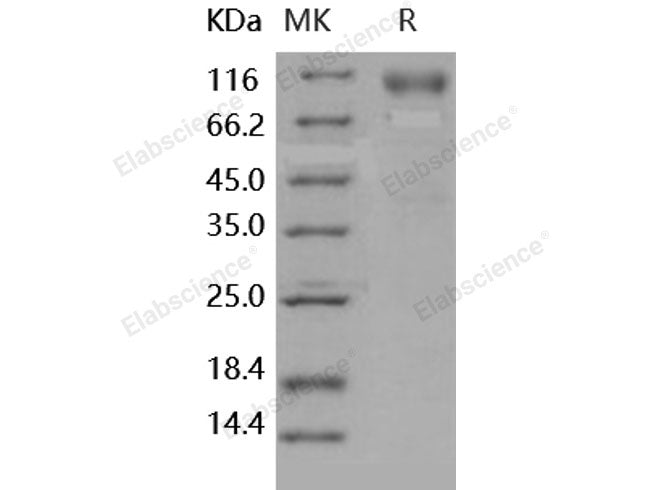 Recombinant Human CNDP2/CPGL/PEPA Protein (His Tag)