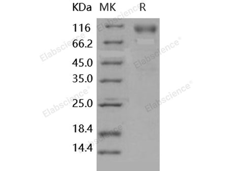 Recombinant Human CCL22/MDC Protein (His Tag)