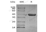 Recombinant Human Cathepsin Z Protein (His Tag)(Active)
