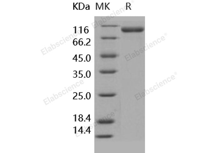 Recombinant Human CD31/PECAM1 Protein (His Tag)(Active)