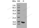 Recombinant Human IL-1 beta/IL1B Protein (Active)