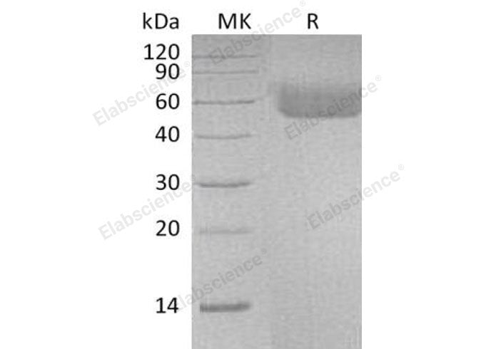 Recombinant Human IL1R1/CD121a Protein